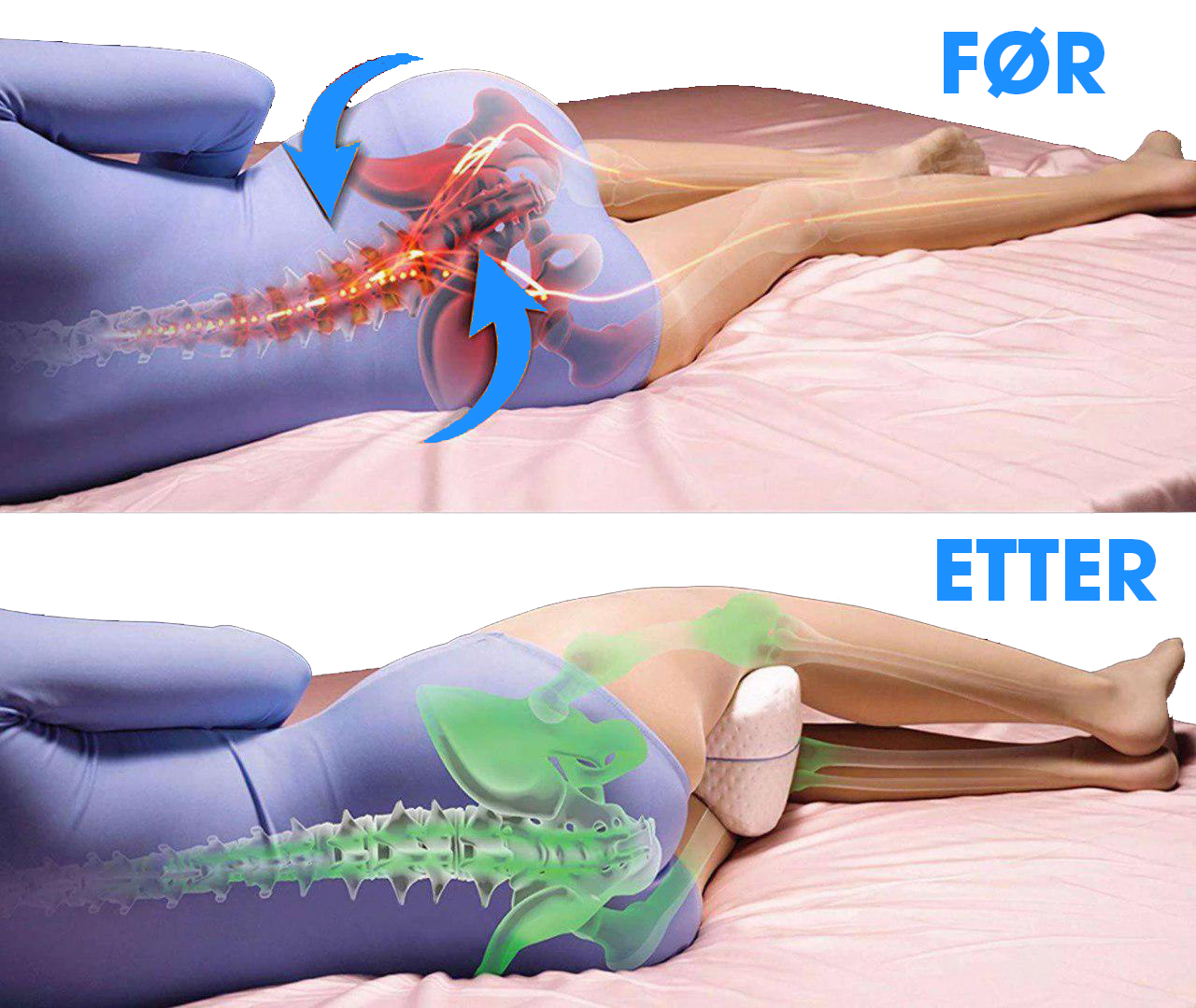 SleepHeart™ – Ortopedisk knépute - NordKlover